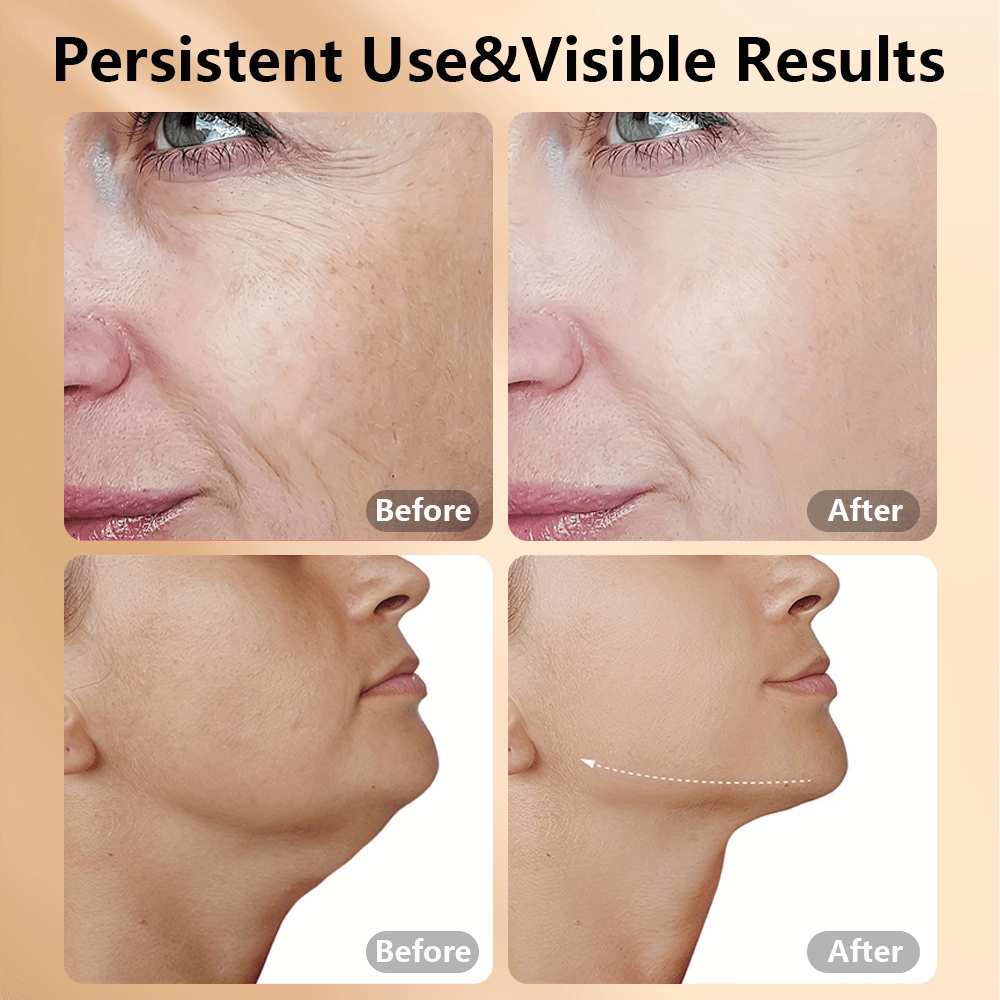 Mpow 3-in-1 Beauty Massager for Face and Neck